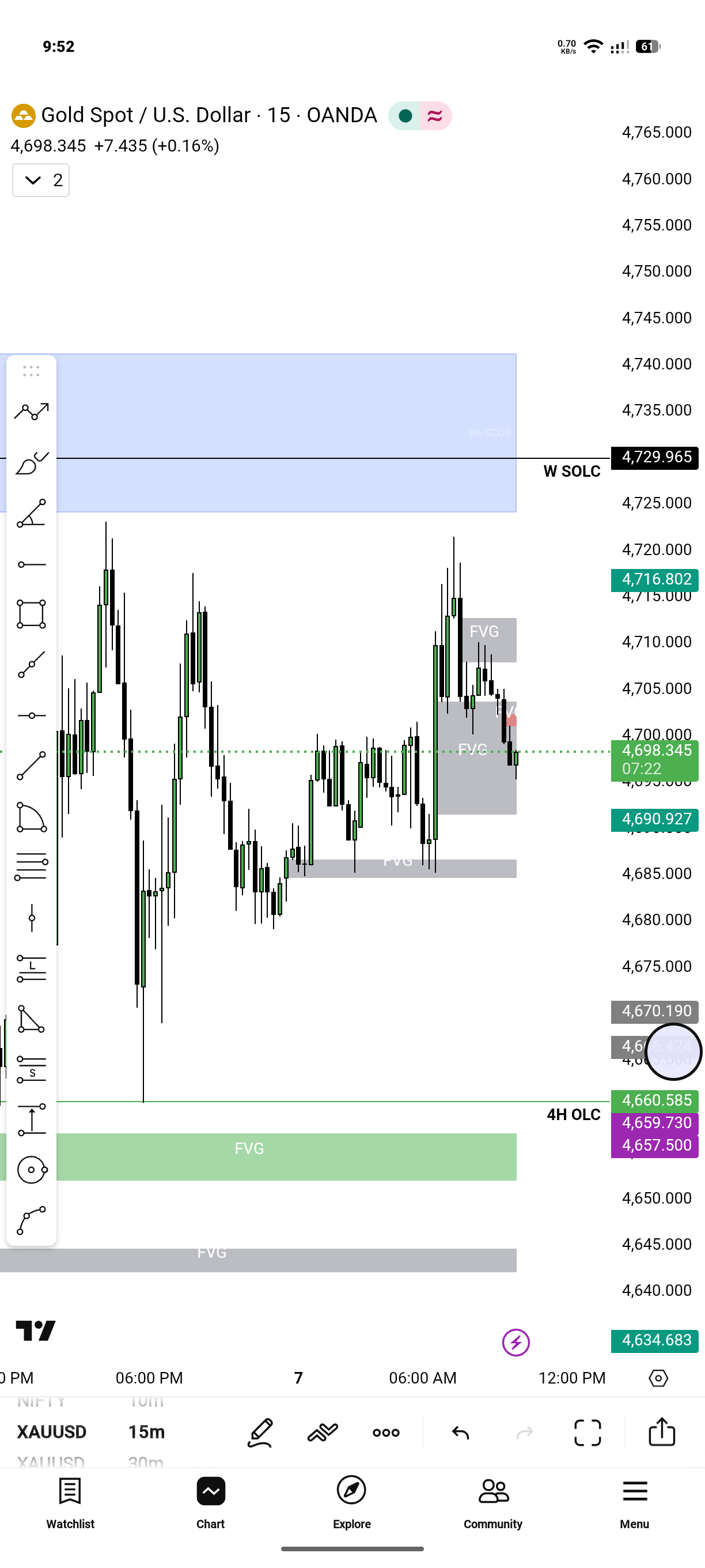 XAUUSD Gold Price Analysis Today – 15 Minute Smart Money Concept Setup & Intraday Trade Plan